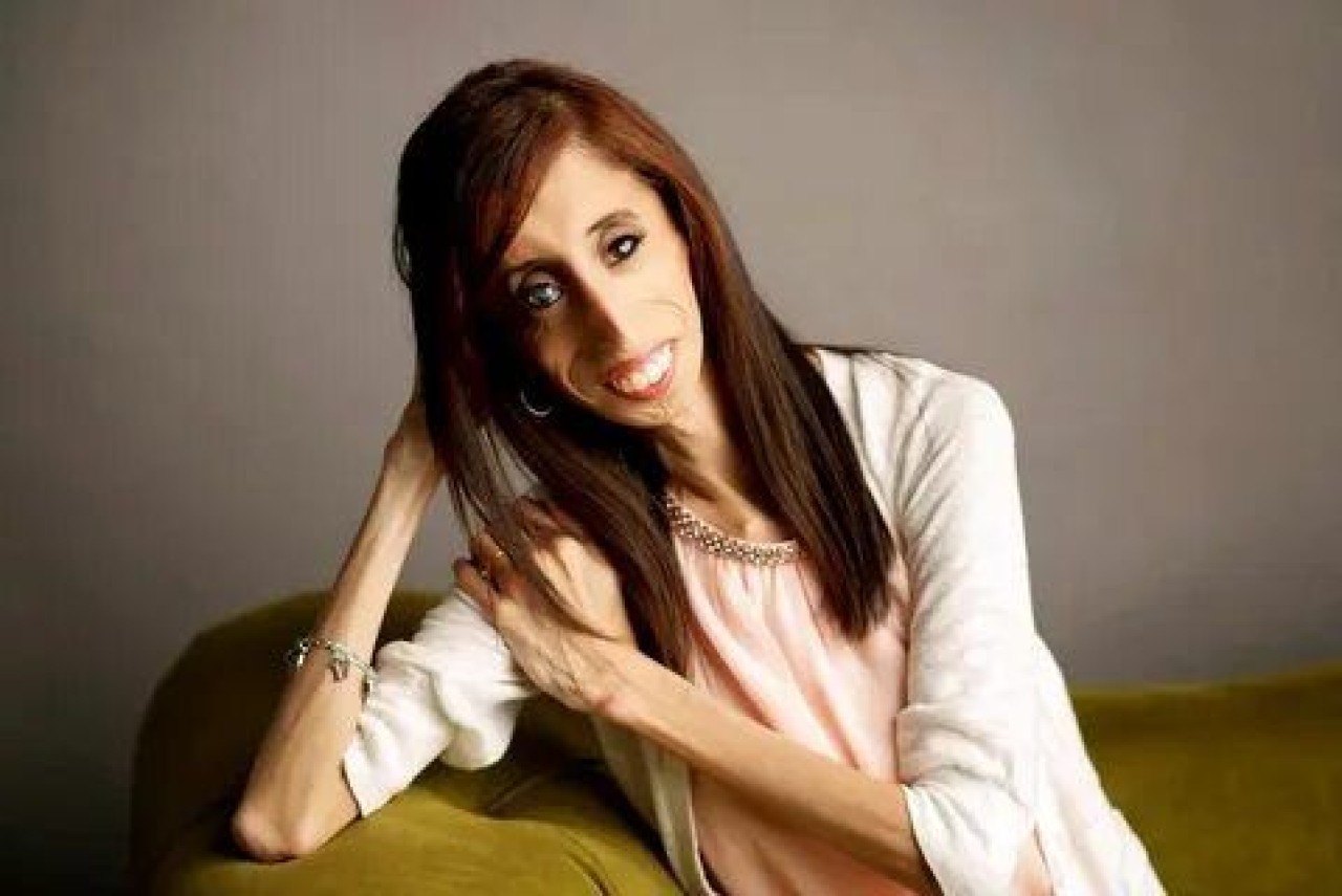 Lizzie velasquez: Dünyanın en çirkin kadını değil, en cesur kadını... 1