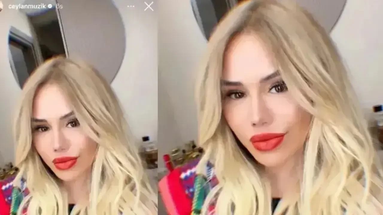 Ceylan'ın Estetikli Hali Şoke Etti 3