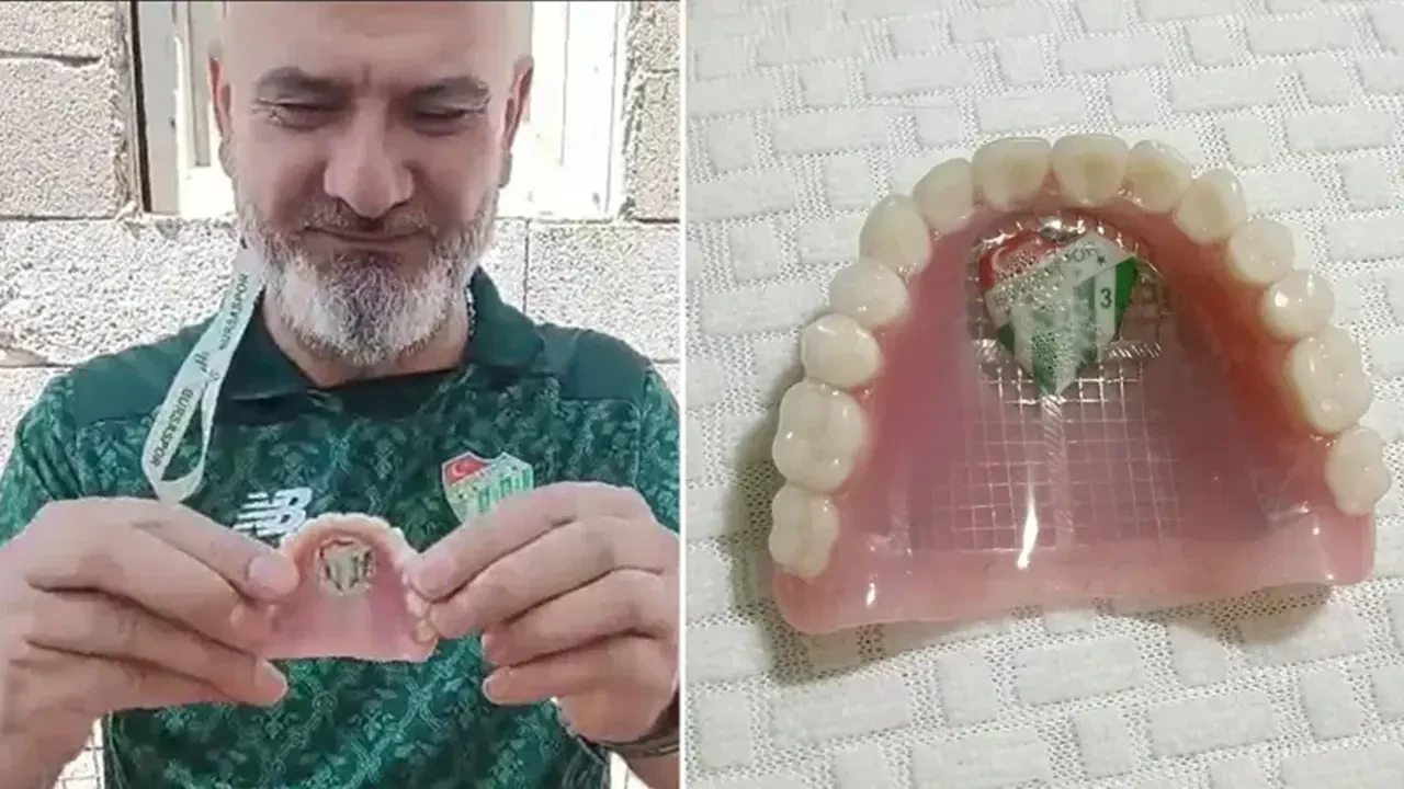 Takımının Armasını Damağına Yaptırdı 4