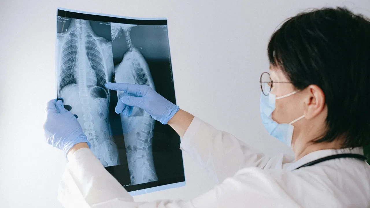 Akciğer Kanseri Neden Olur? 8 Neden Olan Faktör!