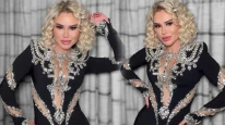 Ceylan'ın Estetikli Hali Şoke Etti