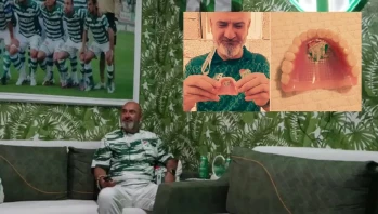 Takımının Armasını Damağına Yaptırdı