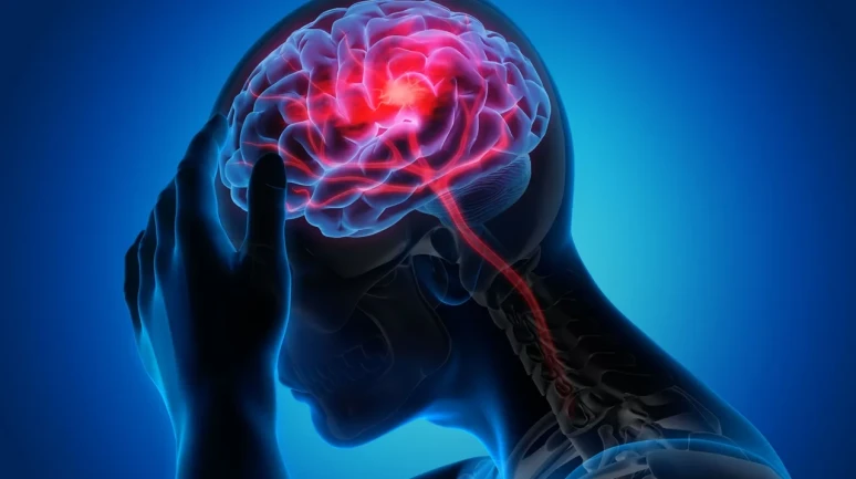 Migrenli Beyin “Önemsizi” Ayıramıyor