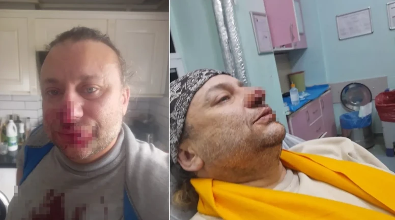 Sanatçı Onur Akay Entübe Edildi