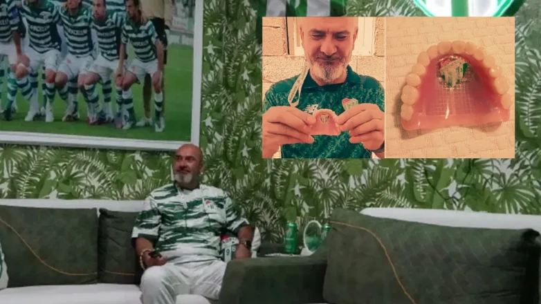 Takımının Armasını Damağına Yaptırdı