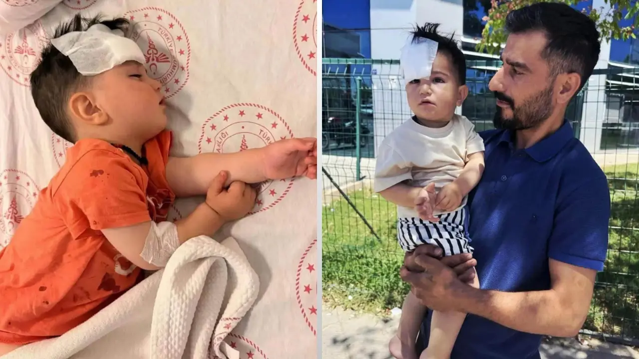 Muhammed Ali Aral köpek saldırısı